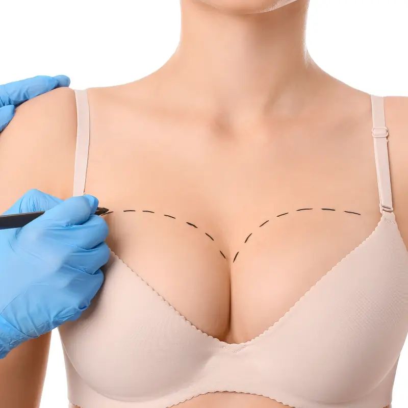 Plastic Surgery