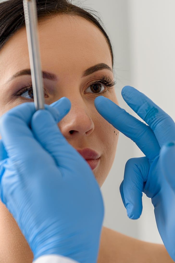 Rhinoplasty